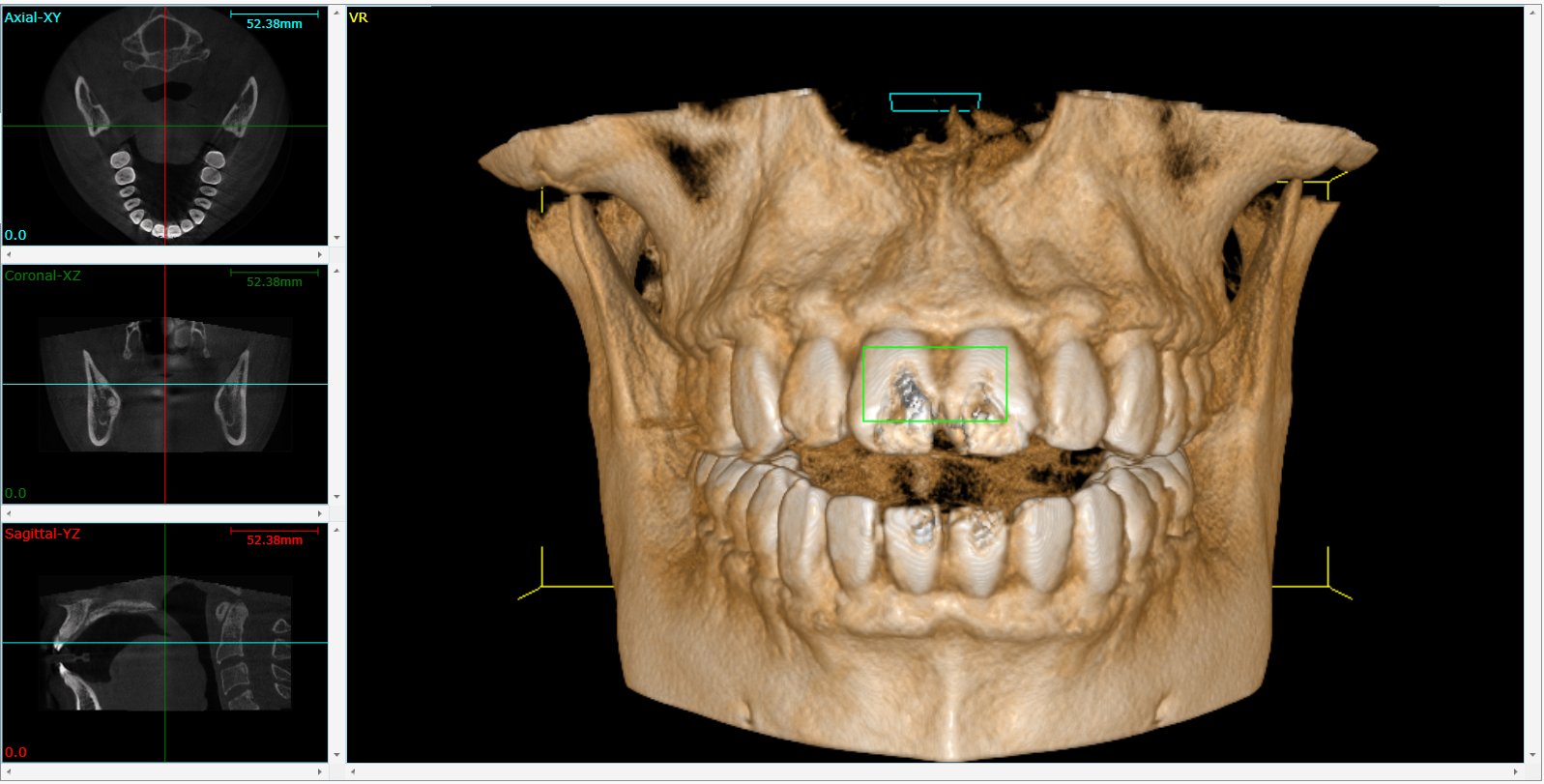 Cone Beam 3D Imaging Glen Carbon, IL 