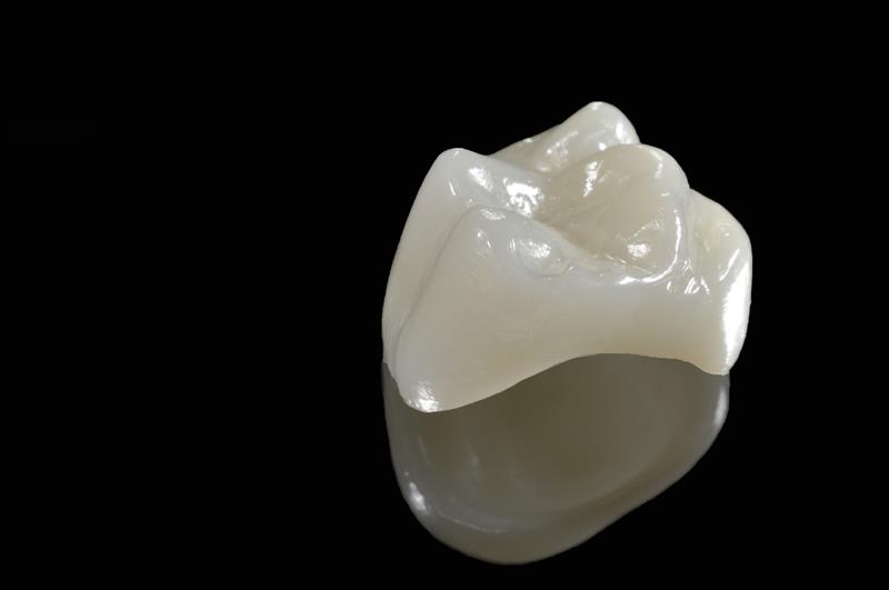 Porcelain Crowns Glen Carbon, IL 